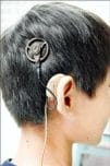 人工電子耳補助
